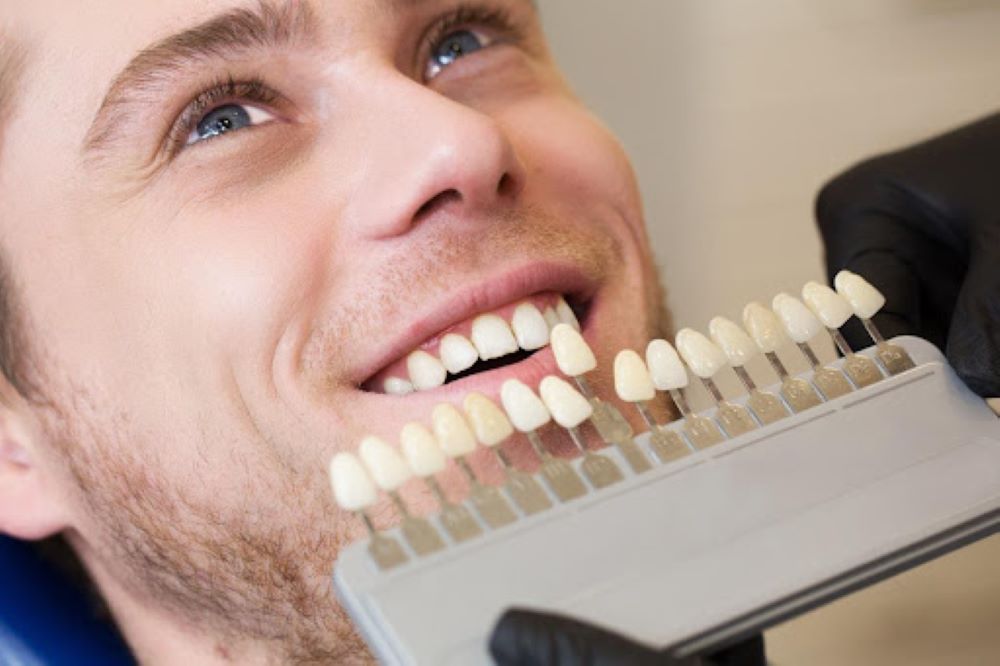 What Is the Process for Getting Same Day Crowns