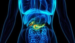Pancreatic cancer and its symptoms