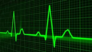 Have an Irregular Heartbeat?